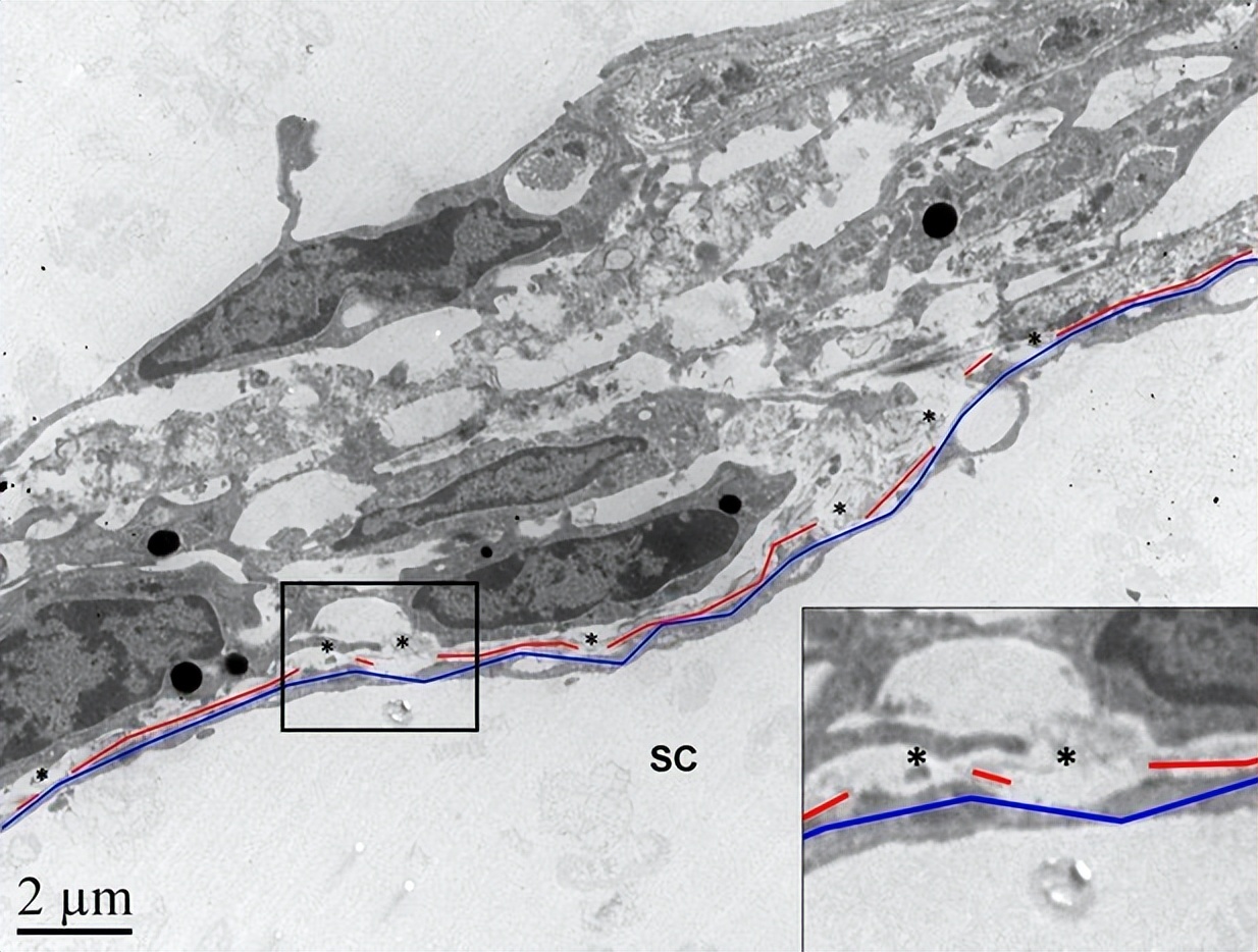 rho激酶抑制剂多少钱,rho激酶抑制剂是什么