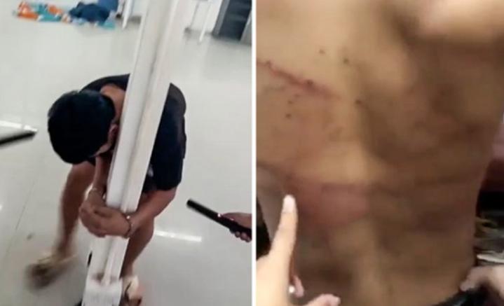 东南亚远比你想象中更可怕：电击、水牢、吃屎，挖器官不打麻药