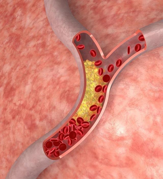 阿托伐他汀长期服用有什么后果,阿托伐他汀有必要长期服用吗