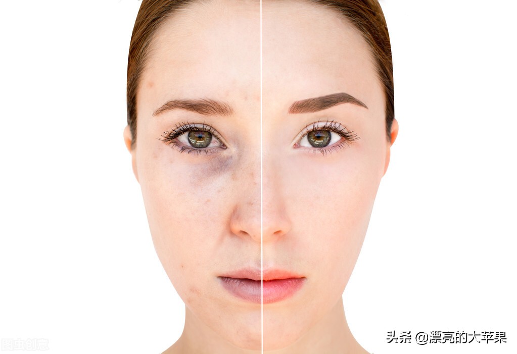 美白内调方法全身,美白方法全身白