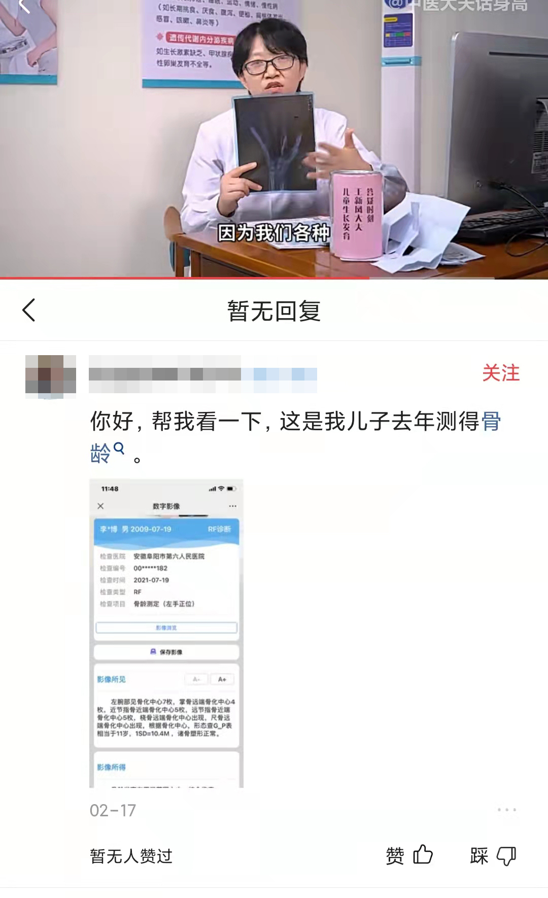 拍骨龄片的正确姿势,如何通过骨龄片看骨龄