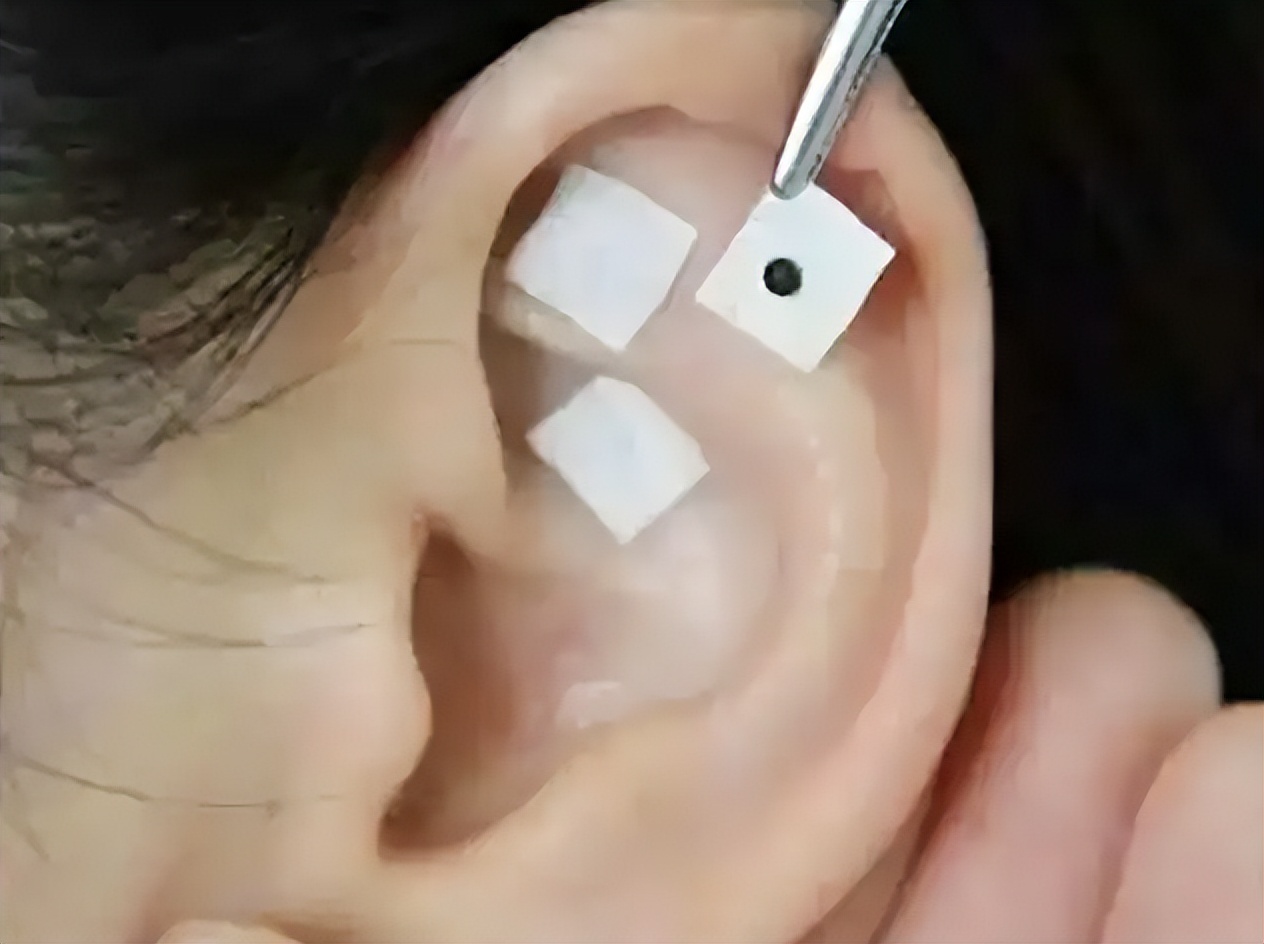 如何用中医治疗轻度抑郁,中西医结合治抑郁