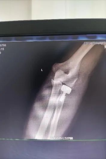 优秀！重庆两江新区中医院年度十佳技术出炉！