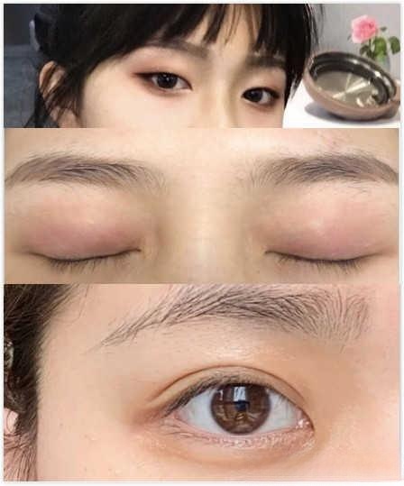 上海做双眼皮哪个医院好,上海哪个医院做双眼皮最好