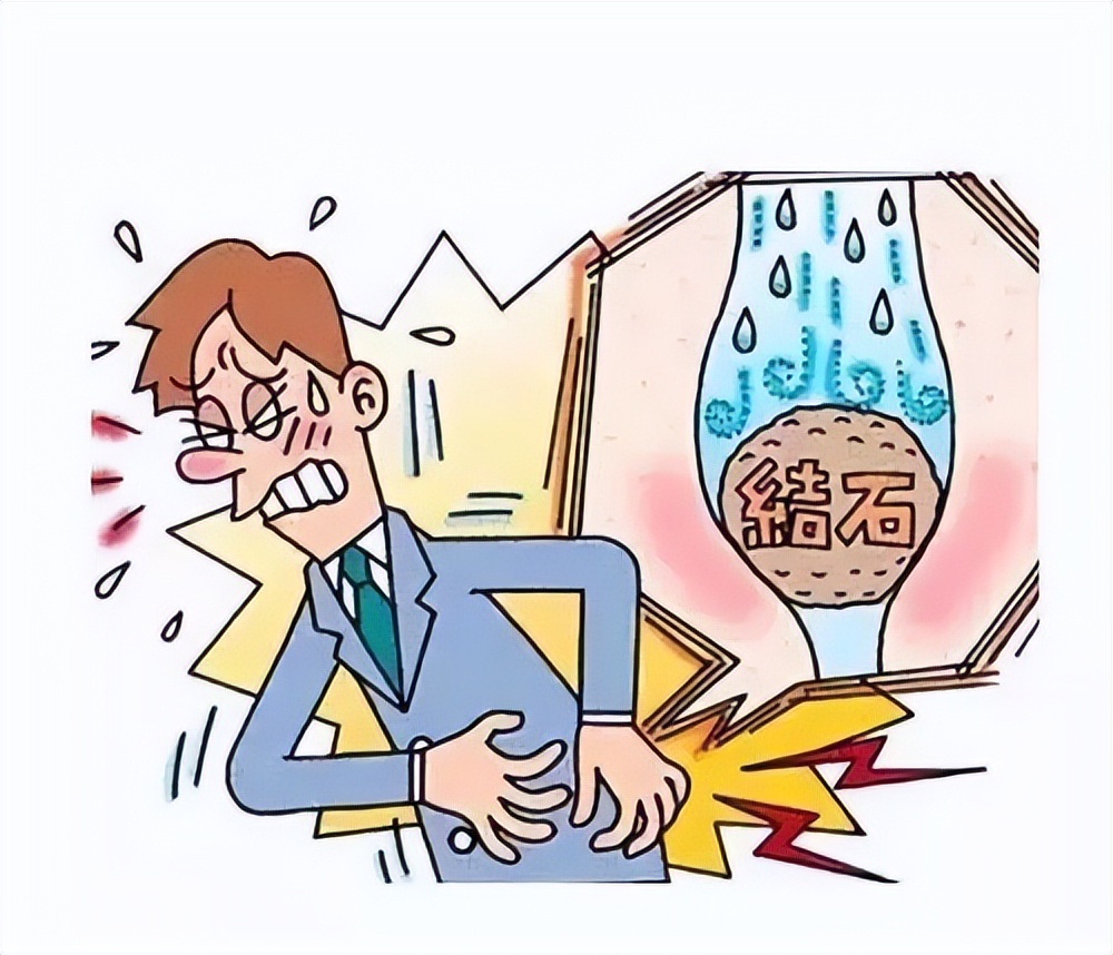 肾结石的自白书：我是肾结石，这是我兴风作浪的一生