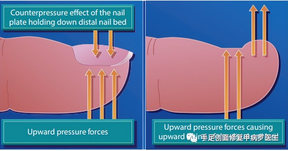 宝宝脚趾甲有脓了怎么处理,给宝宝剪指甲流脓怎么办