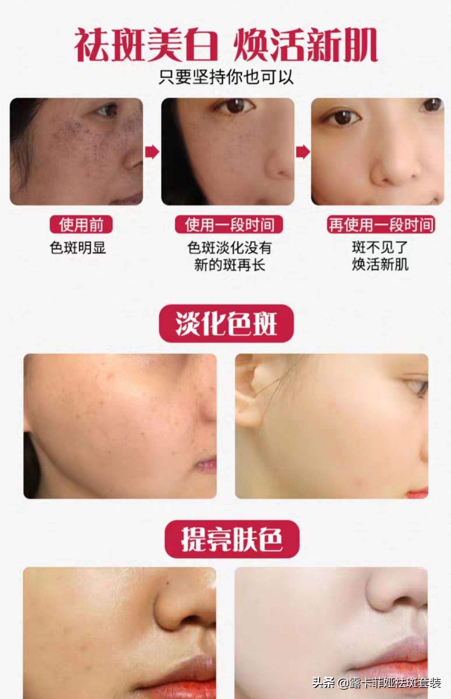 祛斑效果排名第一产品有哪些,哪个牌子的祛斑产品最有效果最好