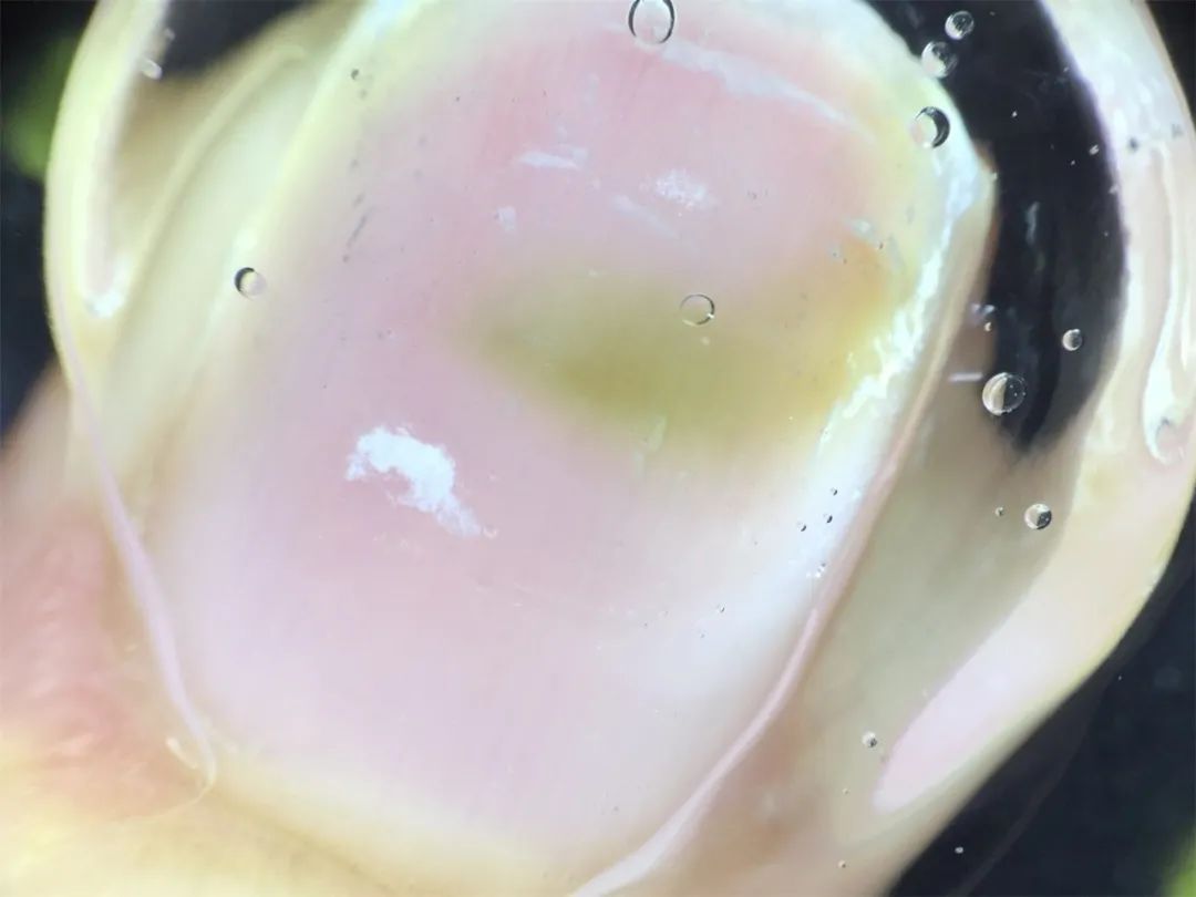 指甲长绿菌接着美甲有什么后果,指甲上长了绿霉菌和美甲店有关吗