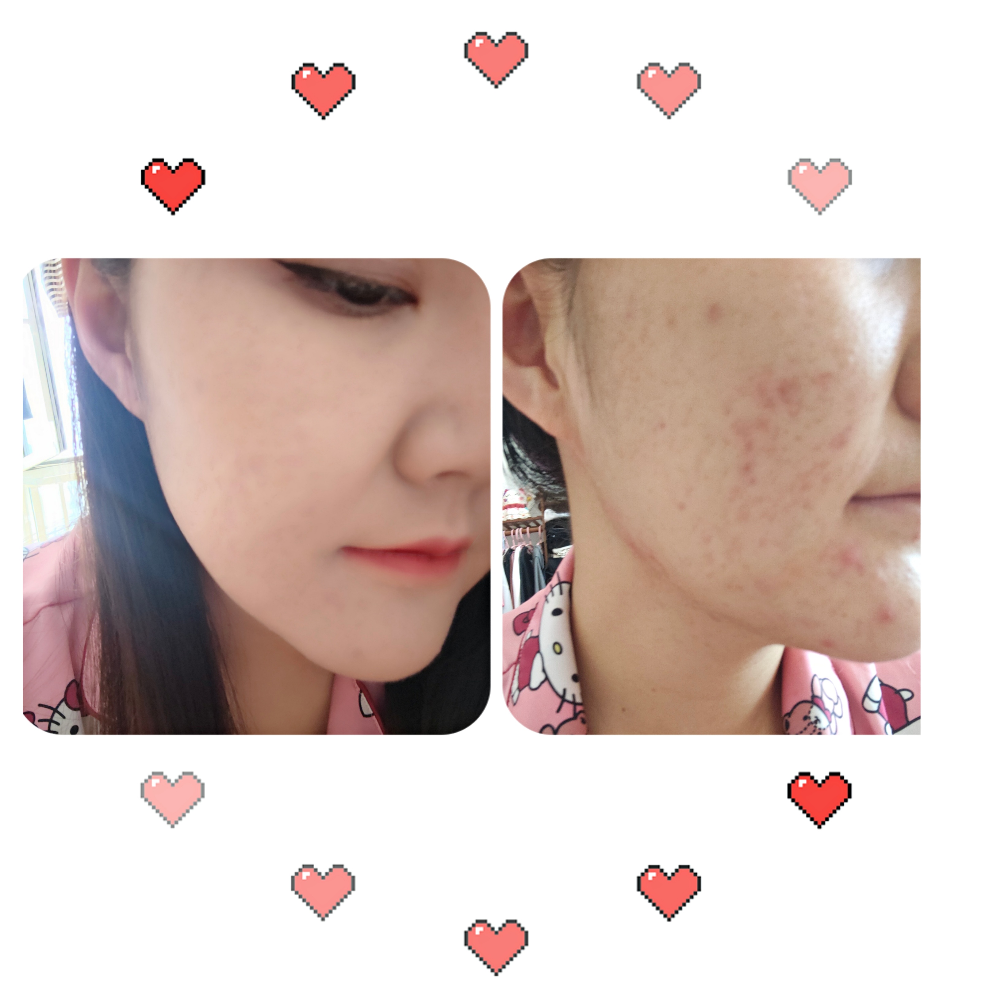 雅诗兰黛dw粉底液适合什么皮肤,粉底液夏天推荐兰蔻