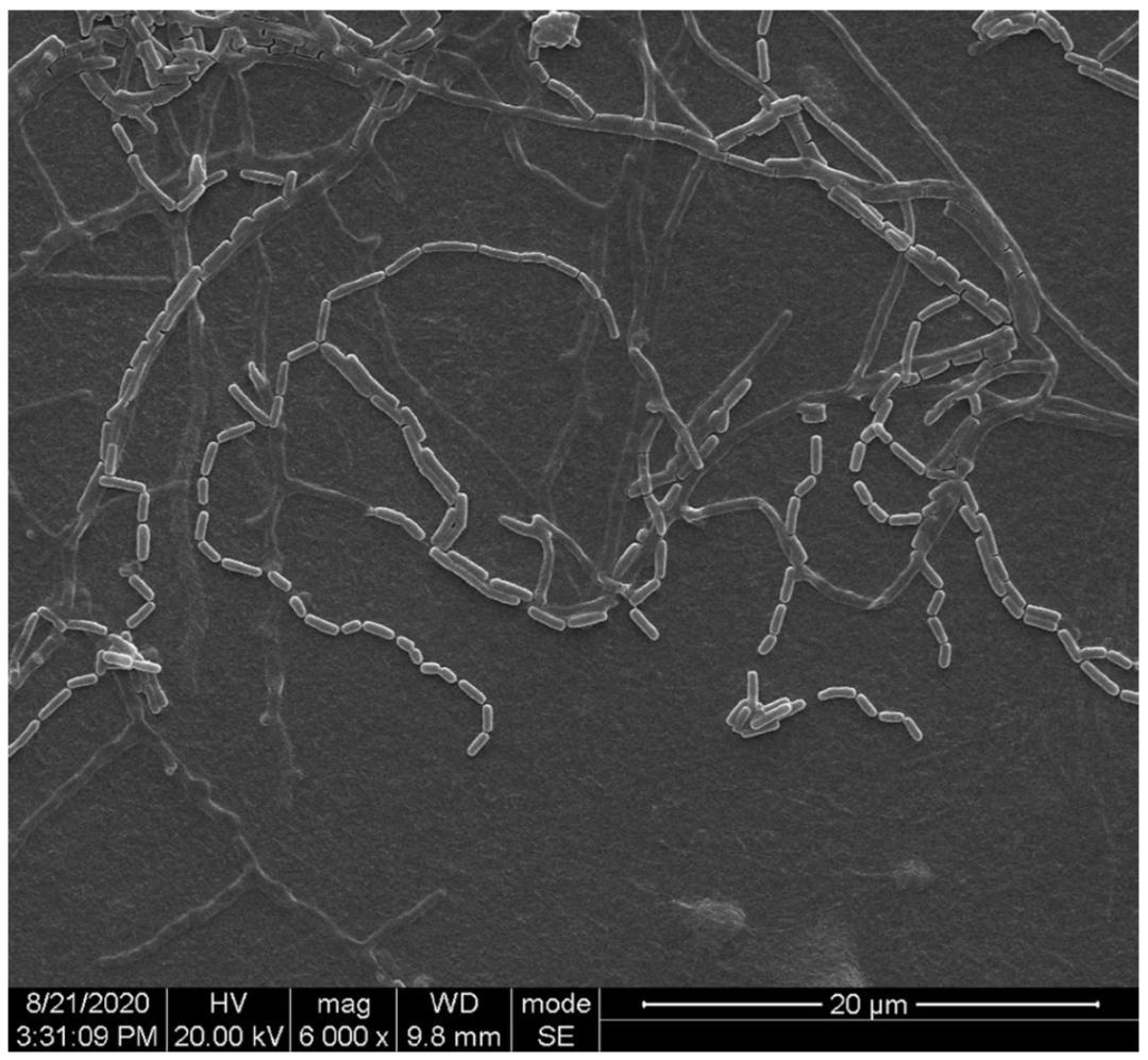 这种新的致病菌被命名为“华西诺卡菌”