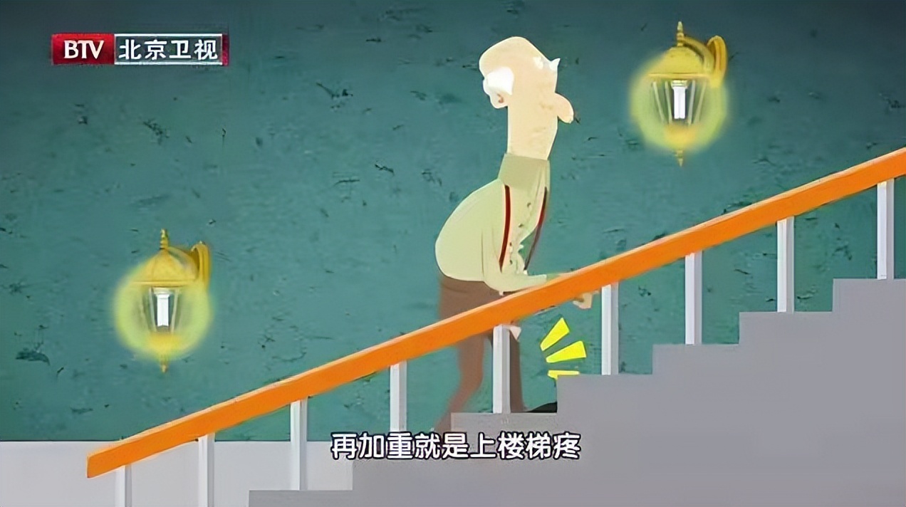 一上楼梯膝盖软痛什么症状,上下楼梯膝盖难受怎么治