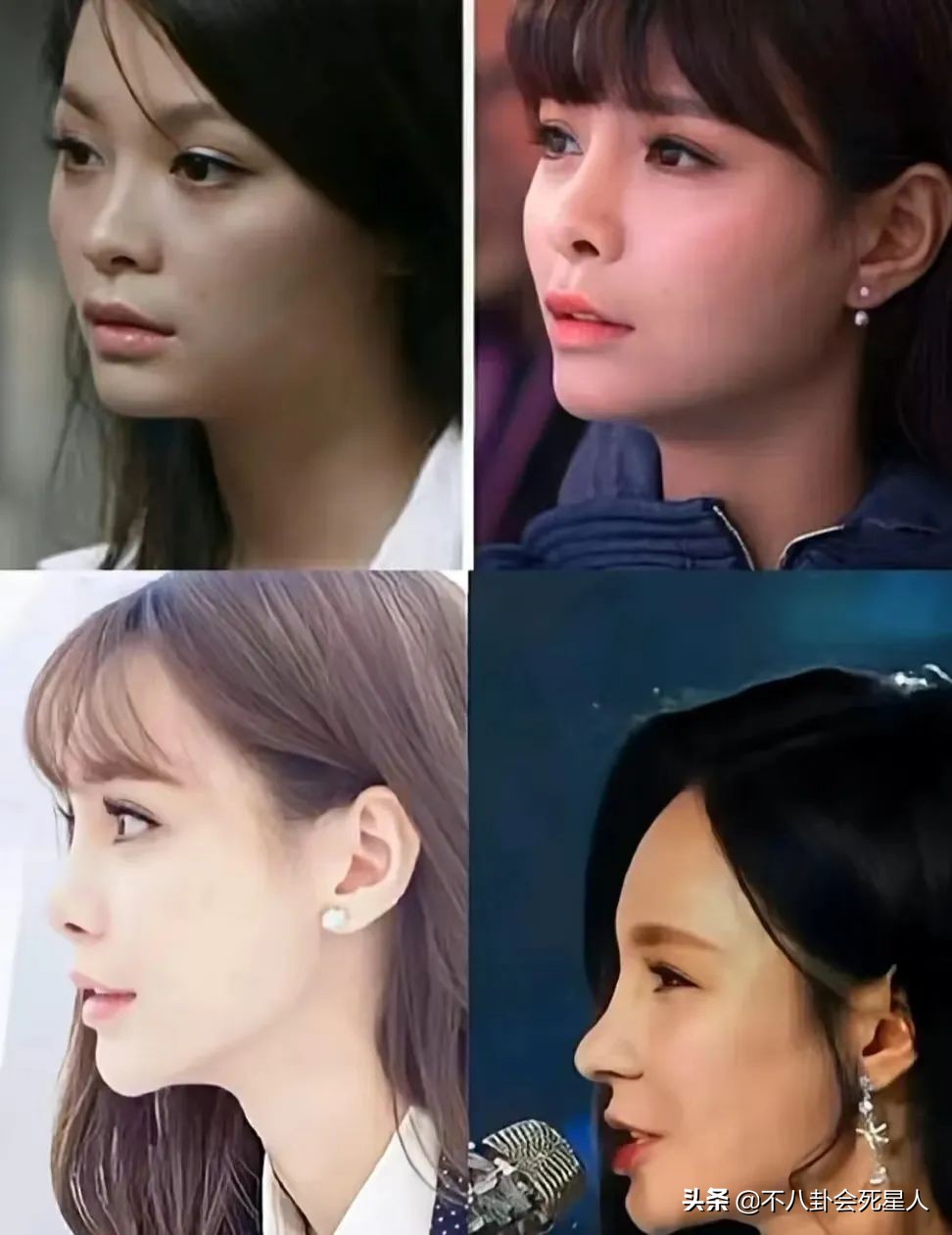 杨雪的脸怎么了,杨雪毁容了吗