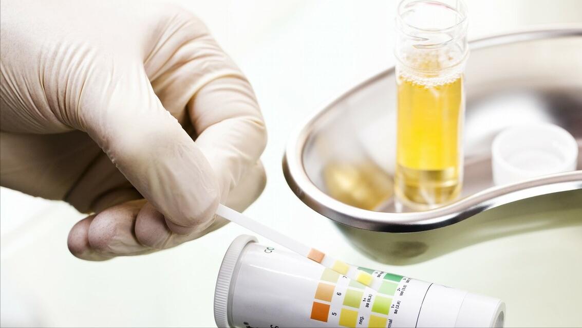 肾脏发出的预警信号你读懂了吗,肾的预警信号