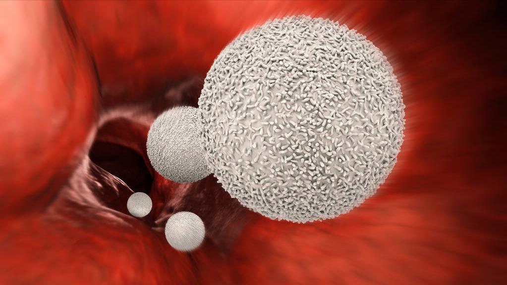 为什么高尿酸不建议吃非布司他,尿酸高伤害哪些内脏
