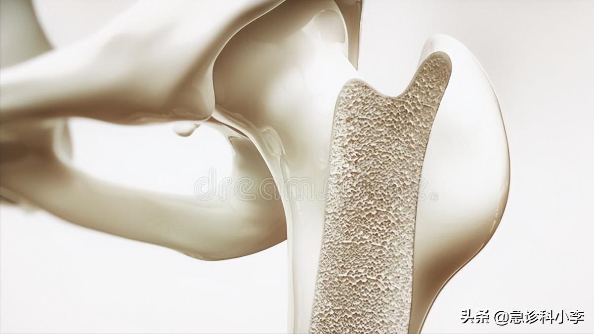 膝盖打封闭针是什么样子的,膝盖疼有必要打封闭针吗