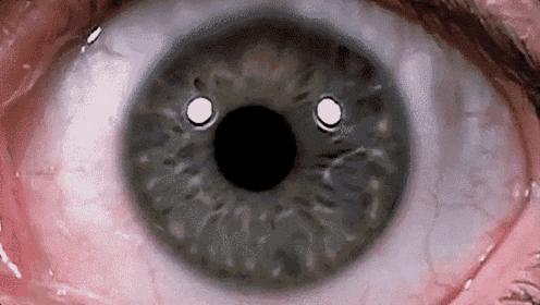 我鼻子呢？我怎么看不见了？