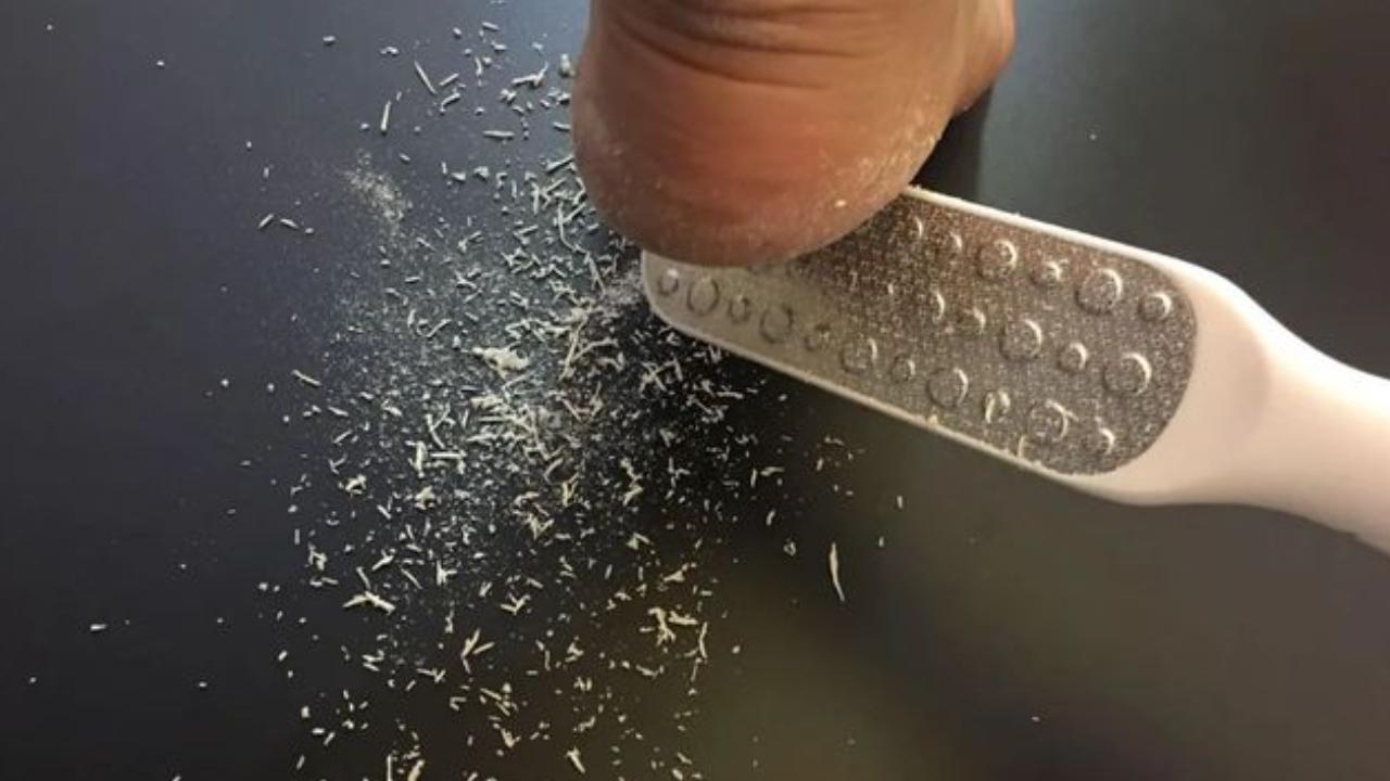 脚底板爱紫是什么原因,脚底板爱起皮是怎么回事