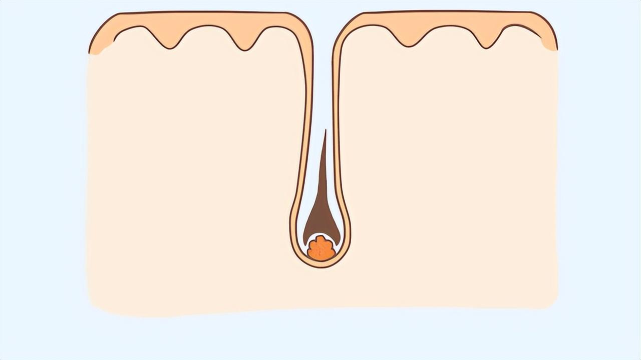 阴毛有什么用，要不要刮掉？阴毛的变化可能暗示什么疾病？望了解