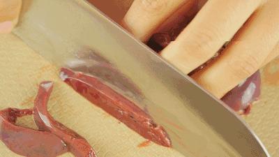 体检缺铁看哪个检查项目,体检查出有贫血的症状怎么办