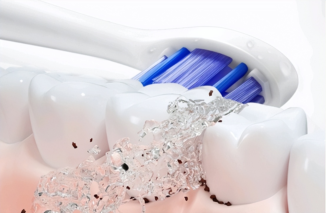 欧乐b电动牙刷对比飞利浦,欧乐b和飞利浦电动牙刷评测