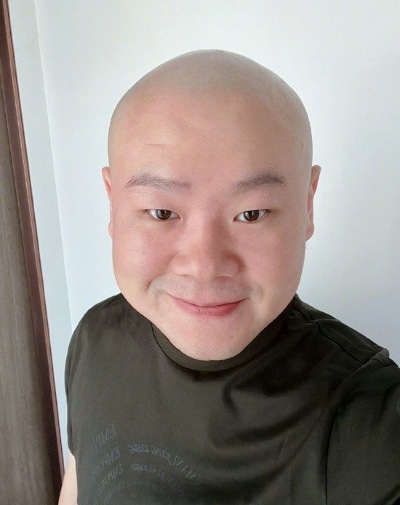 岳云鹏得腮腺瘤原视频,岳云鹏脂肪瘤