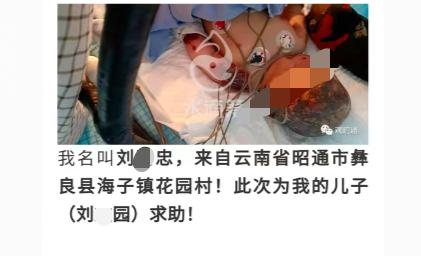 云南一女子癫痫发作怀中婴儿跌入火炉治疗费预估40万53岁丈夫携捐款失联