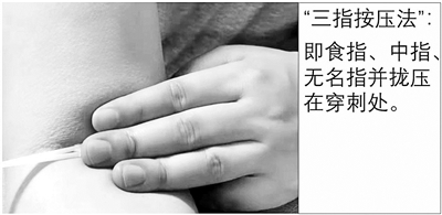 动脉抽血后整条血管发青,胳膊抽血的地方青了一片怎么缓解