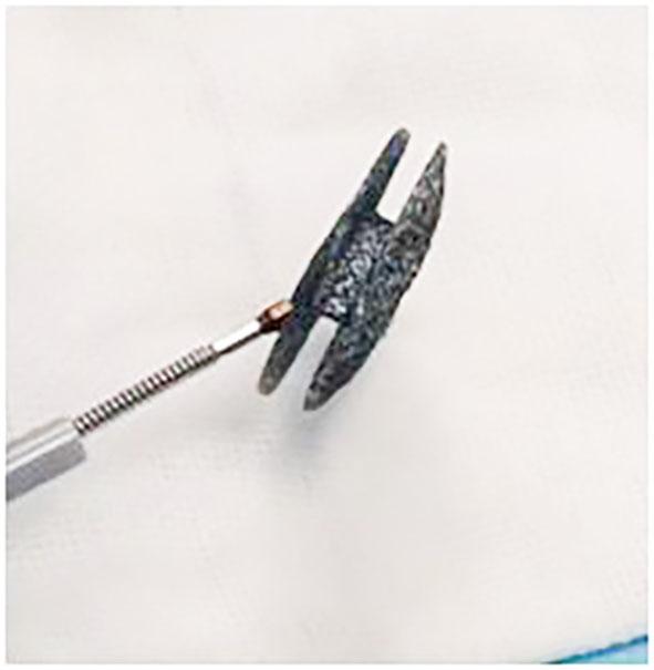 严重心衰安装心脏起搏器作用大吗,慢性心衰改善心室重构治疗方案