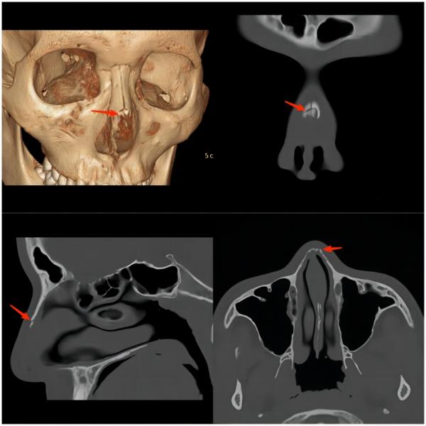健康小知识运动损伤的常见症状,运动损伤知识科普宣传内容