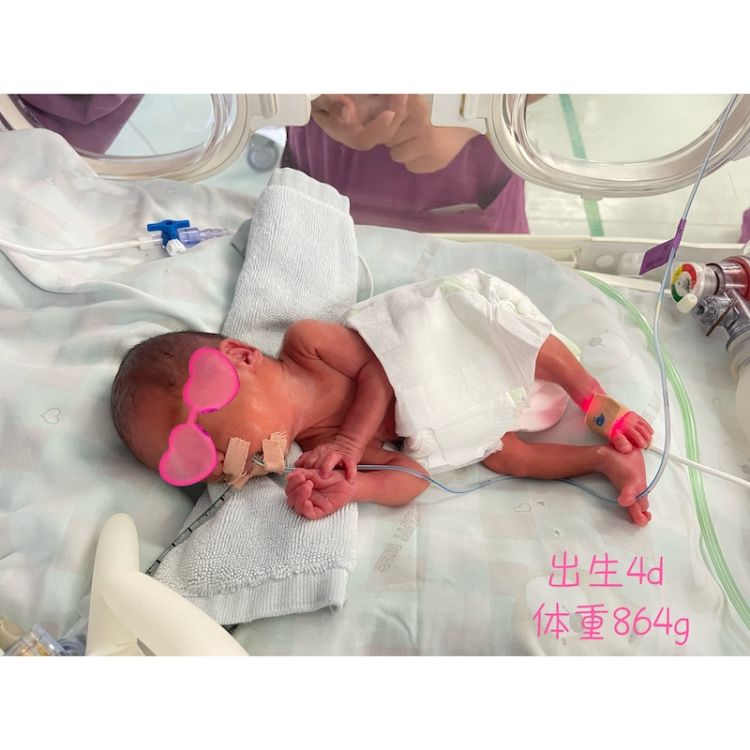 25周的胎宝宝有2斤吗,25周出生的宝宝750克可以存活吗