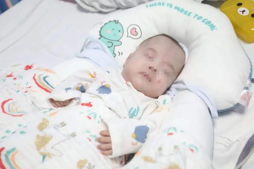 胎停一周救活了,胎龄不满28周超早产儿获救