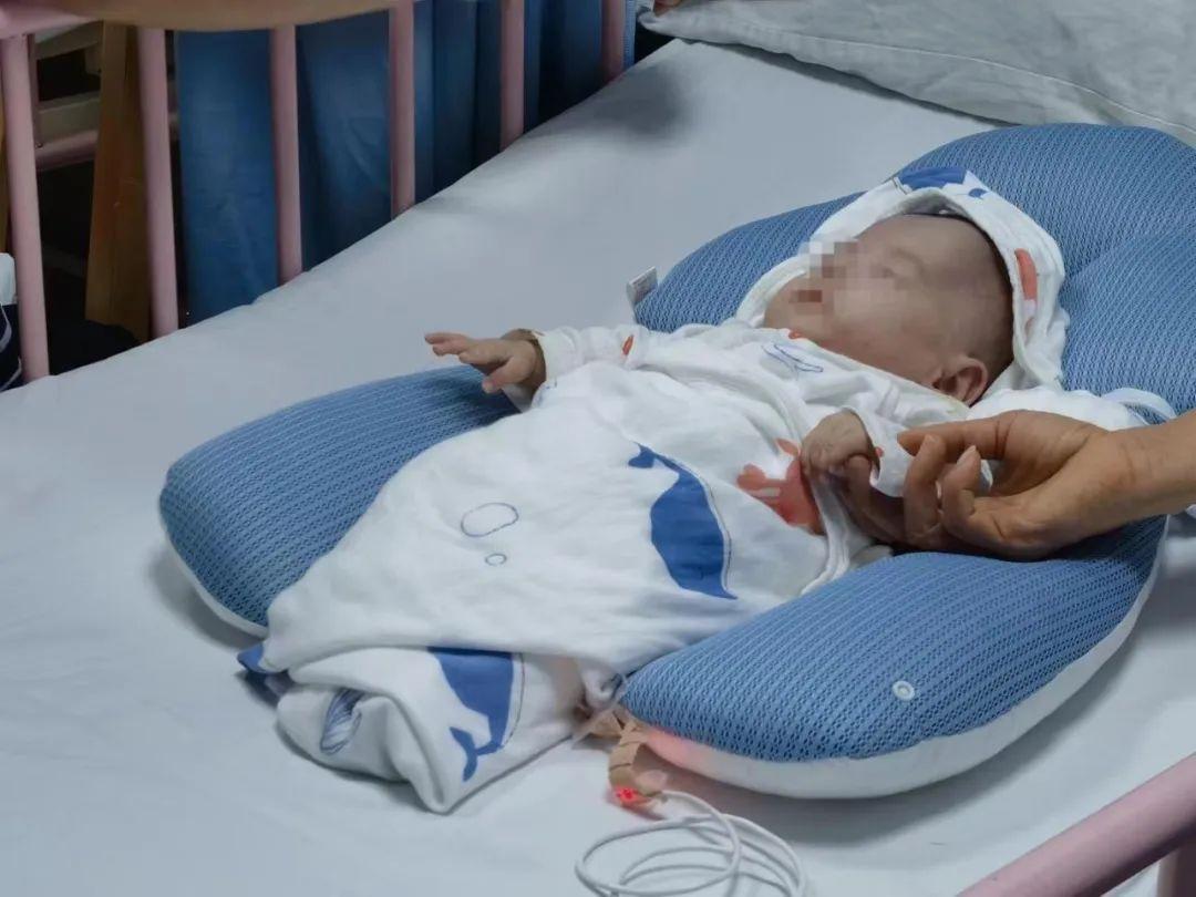 胎停一周救活了,胎龄不满28周超早产儿获救